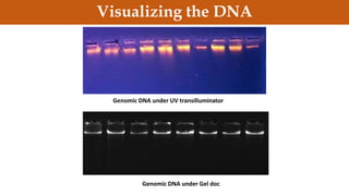 Genomic DNA under UV transilluminator
Genomic DNA under Gel doc
Visualizing the DNA
 