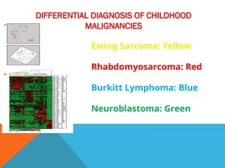 DIFFERENTIAL DIAGNOSIS OF CHILDHOOD
MALIGNANCIES
Ewing Sarcoma: Yellow
Rhabdomyosarcoma: Red
Burkitt Lymphoma: Blue
Neuroblastoma: Green
 