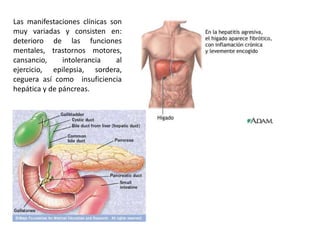 Las manifestaciones clínicas son
muy variadas y consisten en:
deterioro de las funciones
mentales, trastornos motores,
cansancio,     intolerancia    al
ejercicio, epilepsia, sordera,
ceguera así como insuficiencia
hepática y de páncreas.
 