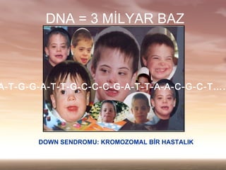 DNA = 3 M?LYAR BAZ



A-T-G-G-A-T-T-G-C-C-C-G-A-T-T-A-A-C-G-C-T




       DOWN SENDROMU: KROMOZOMAL B?R HASTALIK
 