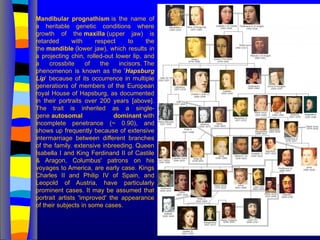 Mandibular prognathism is the name of
a heritable genetic conditions where
growth of the maxilla (upper jaw) is
retarded with respect to the
the mandible (lower jaw), which results in
a projecting chin, rolled-out lower lip, and
a crossbite of the incisors. The
phenomenon is known as the 'Hapsburg
Lip' because of its occurrence in multiple
generations of members of the European
royal House of Hapsburg, as documented
in their portraits over 200 years [above].
The trait is inherited as a single-
gene autosomal dominant with
incomplete penetrance (~ 0.90), and
shows up frequently because of extensive
intermarriage between different branches
of the family. extensive inbreeding. Queen
Isabella I and King Ferdinand II of Castile
& Aragon, Columbus' patrons on his
voyages to America, are early case. Kings
Charles II and Philip IV of Spain, and
Leopold of Austria, have particularly
prominent cases. It may be assumed that
portrait artists 'improved' the appearance
of their subjects in some cases.
 