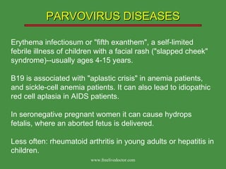 PARVOVIRUS DISEASES Erythema infectiosum or "fifth exanthem", a self-limited febrile illness of children with a facial rash ("slapped cheek" syndrome)--usually ages 4-15 years. B19 is associated with "aplastic crisis" in anemia patients, and sickle-cell anemia patients. It can also lead to idiopathic red cell aplasia in AIDS patients.  In seronegative pregnant women it can cause hydrops fetalis, where an aborted fetus is delivered. Less often: rheumatoid arthritis in young adults or hepatitis in children.  www.freelivedoctor.com 