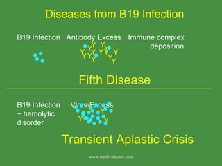 Diseases from B19 Infection B19 Infection  Antibody Excess Immune complex deposition Fifth Disease B19 Infection  Virus Excess + hemolytic disorder  Transient Aplastic Crisis Y Y Y Y Y Y Y Y Y Y Y Y Y Y Y Y Y Y www.freelivedoctor.com 