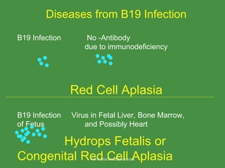 Diseases from B19 Infection B19 Infection   No -Antibody  due to immunodeficiency Red Cell Aplasia B19 Infection  Virus in Fetal Liver, Bone Marrow, of Fetus  and Possibly Heart   Hydrops Fetalis or  Congenital Red Cell Aplasia  www.freelivedoctor.com 