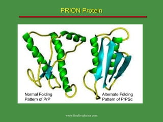 PRION Protein Normal Folding Pattern of PrP  Alternate Folding Pattern of PrPSc  www.freelivedoctor.com 