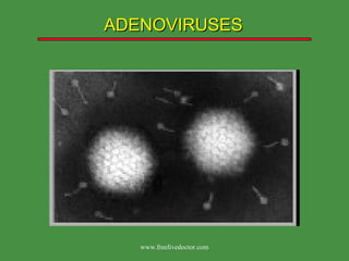 ADENOVIRUSES   www.freelivedoctor.com 