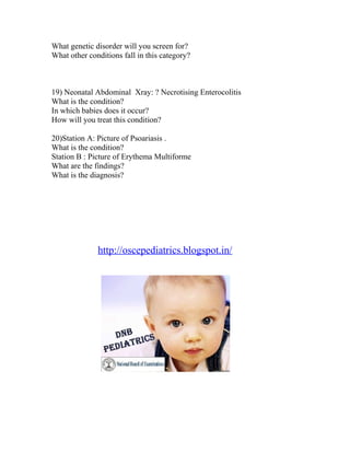 What genetic disorder will you screen for?
What other conditions fall in this category?

19) Neonatal Abdominal Xray: ? Necrotising Enterocolitis
What is the condition?
In which babies does it occur?
How will you treat this condition?
20)Station A: Picture of Psoariasis .
What is the condition?
Station B : Picture of Erythema Multiforme
What are the findings?
What is the diagnosis?

http://oscepediatrics.blogspot.in/

 