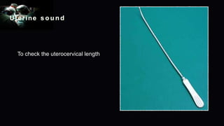 Uterine s o u n d
To check the uterocervical length
 