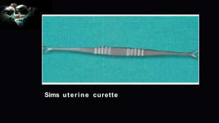 Sims uterine curette
 