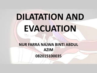 DILATATION AND
EVACUATION
NUR FARRA NAJWA BINTI ABDUL
AZIM
082015100035
 