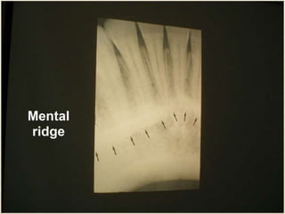D Normal Anatomy in Dental Radiography.pptx