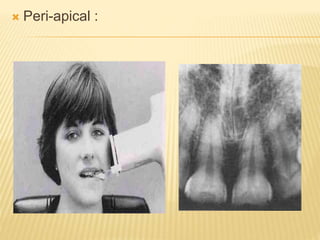 D Normal Anatomy in Dental Radiography.pptx