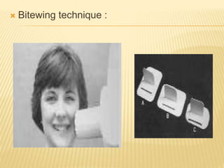 D Normal Anatomy in Dental Radiography.pptx