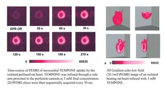 3D Gradient echo low field
(20.1mT)PEDRI image of an isolated
beating rat heart infused with 3 mM
TEMPONE.
Time-course of PEDRI of myocardial TEMPONE uptake by the
isolated perfused rat heart. TEMPONE was infused through a side
arm proximal to the perfusion cannula at 3 mM final concentration.
2D PEDRI slices were then sequentially acquired every 30 sec
 