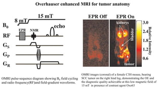 Overhauser enhanced MRI for tumor anatomy
OMRI pulse-sequence diagram showing B0 field cycling
and radio frequency(RF)and field-gradient waveforms.
OMRI images (coronal) of a female C3H mouse, bearing
SCC tumor on the right hind leg, demonstrating the OE and
the diagnostic quality achievable at this low magnetic field of
15 mT in presence of contrast agent Oxo63
 