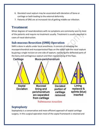 6. Deviated nasal septum may be associated with deviation of bone or
cartilage or both leading to the external deformity.
7. Patients of DNS are at increased risk of getting middle ear infection.
Treatment
Minor degrees of nasal deviations with no symptoms are commonly seen in most
of the patients and require no treatment usually. Treatment is usually required in
cases of nasal obstruction.
Sub mucous Resection (SMR) Operation
SMR is done in adults under local anesthesia. It consists of elevating the
mucoperichondrial and mucoperiosteal flaps on the either side the nasal septum
by giving a single incision on one side of septum, removing the deflected parts of
the bony and cartilaginous septum and then repositioning of the flaps.
Septoplasty
Septoplasty is a conservative and more efficient approach of septal cartilage
surgery. In this surgical operation most of the septal framework is retained and
 