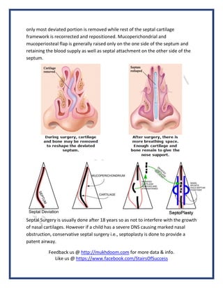 only most deviated portion is removed while rest of the septal cartilage
framework is recorrected and repositioned. Mucoperichondrial and
mucoperiosteal flap is generally raised only on the one side of the septum and
retaining the blood supply as well as septal attachment on the other side of the
septum.
Septal Surgery is usually done after 18 years so as not to interfere with the growth
of nasal cartilages. However if a child has a severe DNS causing marked nasal
obstruction, conservative septal surgery i.e., septoplasty is done to provide a
patent airway.
Feedback us @ http://mukhdoom.com for more data & info.
Like us @ https://www.facebook.com/StairsOfSuccess
 
