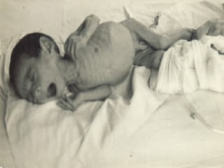 Desnutrición Cero para que nuestros niños y niñas crezcan hasta alcanzar sus sueños