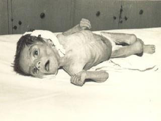 Desnutrición Cero para que nuestros niños y niñas crezcan hasta alcanzar sus sueños