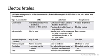 Efectos fetales
RadioGraphics 2017; 37:1840–1850
 