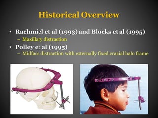 Distraction Osteogenesis in Orthodontics | PPTX