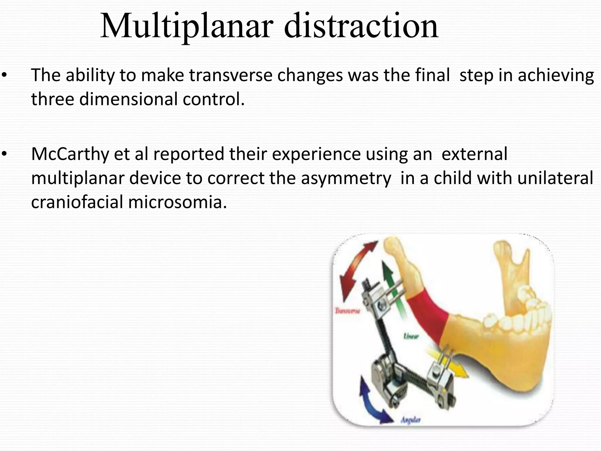 Distraction Osteogenesis | PPTX