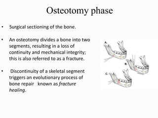 Osteotomy phase
• Surgical sectioning of the bone.
• An osteotomy divides a bone into two
segments, resulting in a loss of
continuity and mechanical integrity;
this is also referred to as a fracture.
• Discontinuity of a skeletal segment
triggers an evolutionary process of
bone repair known as fracture
healing.
 