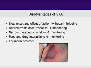 Disadvantages of VKA
• Slow onset and offset of action  heparin bridging
• Unpredictable dose response  monitoring
• Narrow therapeutic window  monitoring
• Food and drug interactions  monitoring
• Coumarin necrosis
 