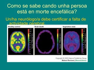 Como se sabe cando unha persoa está en morte encefálica? Un/ha neurólogo/a debe certificar a falta de actividade cerebral. 