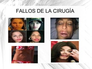 FALLOS DE LA CIRUGÍA

 