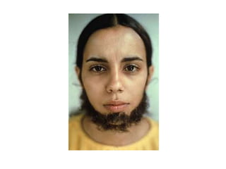 Doble cromosoma xx mona lisa-ícono