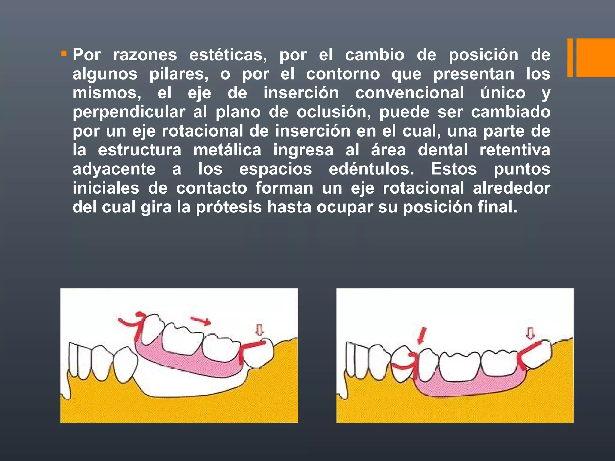 doble eje rotacion al cuidados-de-las-prtesis.pdf