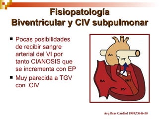 Fisiopatología
Biventricular y CIV subpulmonar
   Pocas posibilidades
    de recibir sangre
    arterial del VI por
    tanto CIANOSIS que
    se incrementa con EP
   Muy parecida a TGV
    con CIV



                           Arq Bras Cardiol 1999;73446-50
 