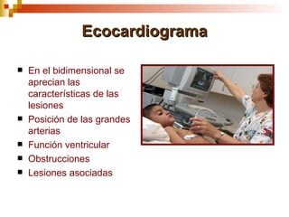 Ecocardiograma

   En el bidimensional se
    aprecian las
    características de las
    lesiones
   Posición de las grandes
    arterias
   Función ventricular
   Obstrucciones
   Lesiones asociadas
 