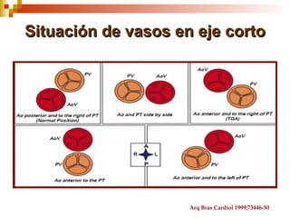 Situación de vasos en eje corto




                     Arq Bras Cardiol 1999;73446-50
 
