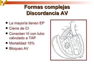 Formas complejas
             Discordancia AV
   La mayoría tienen EP
   Cierre de CI
   Conectan VI con tubo
    valvulado a TAP
   Mortalidad 15%
   Bloqueo AV
 