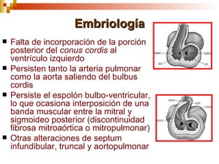 Embriología
   Falta de incorporación de la porción
    posterior del conus cordis al
    ventrículo izquierdo
   Persisten tanto la arteria pulmonar
    como la aorta saliendo del bulbus
    cordis
   Persiste el espolón bulbo-ventricular,
    lo que ocasiona interposición de una
    banda muscular entre la mitral y
    sigmoideo posterior (discontinuidad
    fibrosa mitroaórtica o mitropulmonar)
   Otras alteraciones de septum
    infundibular, truncal y aortopulmonar
 