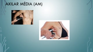 AXILAR MÉDIA (AM)
 