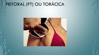 PEITORAL (PT) OU TORÁCICA
 