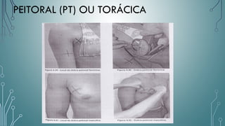 PEITORAL (PT) OU TORÁCICA
 