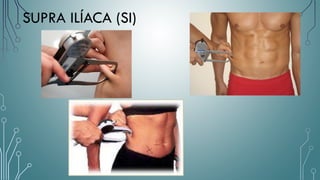 SUPRA ILÍACA (SI)
 