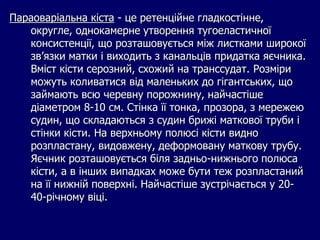 Параоваріальна кіста - це ретенційне гладкостінне,
округле, однокамерне утворення тугоеластичної
консистенції, що розташовується між листками широкої
зв’язки матки і виходить з канальців придатка яєчника.
Вміст кісти серозний, схожий на транссудат. Розміри
можуть коливатися від маленьких до гігантських, що
займають всю черевну порожнину, найчастіше
діаметром 8-10 см. Стінка її тонка, прозора, з мережею
судин, що складаються з судин брижі маткової труби і
стінки кісти. На верхньому полюсі кісти видно
розпластану, видовжену, деформовану маткову трубу.
Яєчник розташовується біля задньо-нижнього полюса
кісти, а в інших випадках може бути теж розпластаний
на її нижній поверхні. Найчастіше зустрічається у 20-
40-річному віці.
 