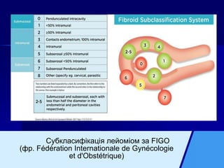 Субкласифікація лейоміом за FIGO
(фр. Fédération Internationale de Gynécologie
et d'Obstétrique)
 