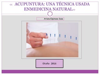 << ACUPUNTURA: UNA TÉCNICA USADA
ENMEDICINA NATURAL>>
Otoño 2016
Ariana Espinosa Sosa
 