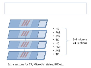 The Renal Biopsy Laboratory handling
• HE
• PAS
• JNS
• TC
• HE
• PAS
• JNS
• TC
3-4 microns
24 Sections
Extra sectons for CR, Microbial stains, IHC etc.
 