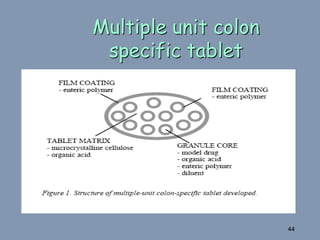 Multiple unit colon
specific tablet
44
 