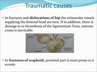 Traumatic causes
 In fractures and dislocations of hip the retinacular vessels
supplying the femoral head are torn. If in addition, there is
damage to or thrombosis of the ligamentum Teres, osteone
crosis is inevitable.
 In fractures of scaphoid, proximal part is more prone to n
ecrosis
 