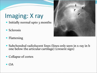 Imaging: X ray
 Initially normal upto 3 months
 Sclerosis
 Flattening
 Subchondral radiolucent lines (lines only seen in x-ray in b
one below the articular cartilage) (cresent sign)
 Collapse of cortex
 OA
 