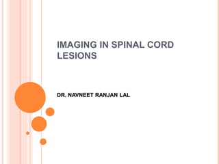 IMAGING IN SPINAL CORD
LESIONS
DR. NAVNEET RANJAN LAL
 
