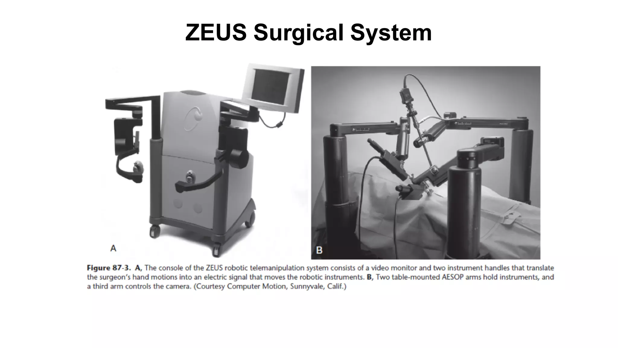 ZEUS Surgical System
 